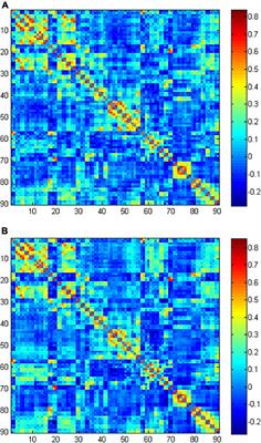 Altered Functional Network in Infants With Profound Bilateral Congenital Sensorineural Hearing Loss: A Graph Theory Analysis